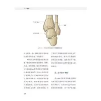 音像Pilon骨折李钊伟,李泽清