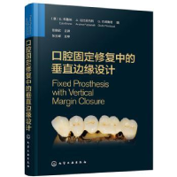 音像口腔固定修复中的垂直边缘设计