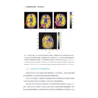 音像脑定量磁共振成像:物理测量原理
