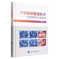 音像子宫输卵管造影术--生殖外科医生的解读(精)关菁
