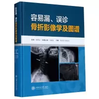 音像容易漏误诊骨折影像学及图谱(精)袁明远