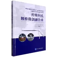 音像经椎间孔腰椎微创融合术王征