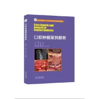 音像口腔种植案例解析文勇