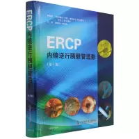 音像ERCP内镜逆行胰胆管造影托德 H.巴隆
