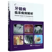 音像牙髓病临床病例解析(精)