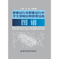 【二手8成新】胆囊结石及胆囊结石华支睾吸虫卵微观结构图谱 9787802459793