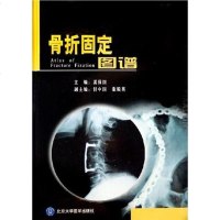 [二手8成新]骨折固定图谱 9787810717663