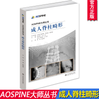 成人脊柱畸形 AOSPINE大师丛书 医学正骨脊柱侧弯矫正外科手术技术 脊柱外科学脊柱畸形