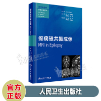 癫痫磁共振成像 姚一 张建国 梁树立 陈蕾 译 人民卫生出版社