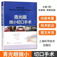 青光眼微小切口手术 上海科学技术出版社