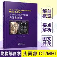 CT/MRI应用解剖学图解:头部和面部:Head & face 韩玉成,孙传怒,沈晓速 978753