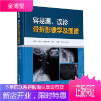 容易漏误诊骨折影像学及图谱(精) 医学 骨折影像诊断图谱 普通大众 图书