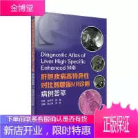 肝胆疾病高特异性对比剂增强MR诊断:病例荟萃 赵心明 医学 9787504688606