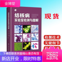 结核病实验室检测与图解 提高结核杆菌检出率 减少肺结核的传播 临床检验医学书籍 卢洪洲 主编