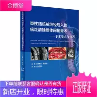 脊柱结核单纯经后入路病灶清除椎体间植骨术--手术要点与技巧张宏其编著脊柱结核外科治疗人民卫生出版