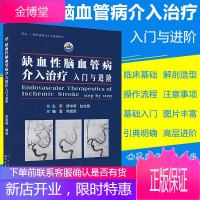 缺血性脑血管病介入治疗入门与进阶 基础入门脑血管解剖造影 临床基础 脑卒中 神经介入医生用书 李晓青