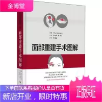 面部重建手术图解