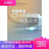 颅脑病变CT与MR对比临床应用