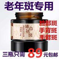 [苏宁专营]祛ban霜雀ban去ban褐ban脸部老年ban黑色素黑ban去点器 男女神通用 送爸爸妈妈 精选特买