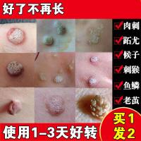 同款电视定制去鱼鳞痣膏休子脚肉刺去除膏脚底老茧足部手上去除猴子刺猴肉刺贴