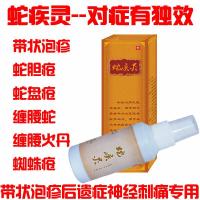 ()蛇盘疮蛇胆疮缠腰蛇疾灵带状百疱泡疹清蛇癍疮拔毒后遗症祛痛痛液