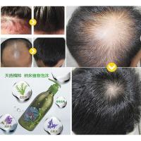 异株荨麻洗发水双重牛蒡根迷迭香无硅植物异株荨麻问荆洗发水蒙药鼠尾