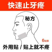 牙神经止疼治牙痛牙疼贴牙神经智齿上火牙龈肿痛贴一分钟止牙疼止疼神器