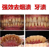 牙膏清除牙石去除牙结石清除 去烟渍牙膏去牙渍防蛀牙膏去牙石牙垢 105g
