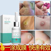 鸦胆子剂初妮赘清生物膜手脚茧刺瘊子鸦胆子剂身体护理
