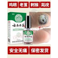 鸡眼膏云南本膏贴去足部手部脚趾日本脚底非去瘊子神器