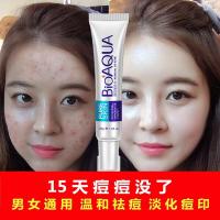 除痘印祛痘疤祛痘膏青春痘粉刺修护脸上治痘印产品逗去痘痘修复痘疤消男女除豆