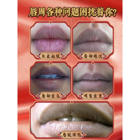 嘴唇膏发黑去除死皮黑色素嘴角暗沉唇膜去黑唇色周唇纹李佳琦 25g