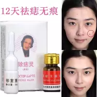 去痣膏去痣点痣药水韦医生去志 点志药水 点志膏 无痕韦医生除志灵 雀斑祛志