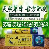 成人湿疹膏苗药癣毒王儿童成人牛皮藓癣外用银屑病皮炎囊湿疹瘙痒止痒药膏