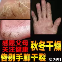 抖音同款护手霜红花防冻蛇油膏冻疮手脚后跟干裂止痒脸耳朵龟裂皲裂愈裂霜