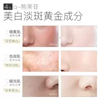 渝崧霜正品抖音同款sod熊果苷乳膏分解黑色素朵珍渝崧霜液