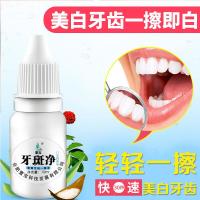 牙变白牙牙齿变神器去黑牙渍烟渍牙垢牙粉液结石牙素牙斑净洗白