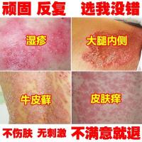 牛皮癣专用皮肤湿疹止痒去根顽固外用瘙痒日本皮炎和股膏
