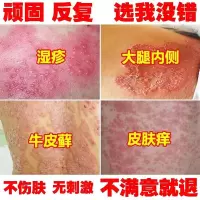 牛皮癣专用皮肤湿疹止痒去根顽固外用瘙痒日本皮炎和股膏