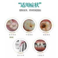 蛀牙修复牙洞清理牙膏龋齿智齿去除黑斑儿童牙痛粉孕妇蛀虫牙神器