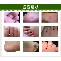 治脚臭去根神器膏泡脚日本抗真菌脚痒王脚藓