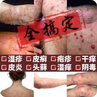 雅美肤本抑菌膏肤痒康成人湿疹膏百止痒膏湿清灵霜湿痒乳膏手足癣身体蚊叮虫咬肛周囊瘙痒皮肤外用膏