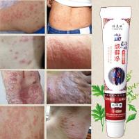 日光性皮炎湿疹寻麻疹紫外线过敏修复成人牛皮癣软膏皮肤瘙痒大腿内侧外用止痒膏头皮癣手足体癣股癣苗乳膏 雅美肤顽藓净本抑