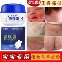 百止痒膏妍缇湿疹膏荨麻抑菌口水癣膏护臀膏儿童护肤面霜蚊虫叮咬消肿膏成人皮肤瘙痒囊痱子软膏堂