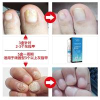 REAM德国成膜技术,去灰指甲一笔亮灰指甲快速修复液冰醋酸去除灰指甲专用水液非德国日本进口正品