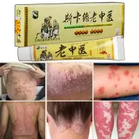 云南本苦参本止痒膏成人慢性湿疹囊瘙痒股癣肛肛周皮肤过敏膏真菌感染大腿内侧瘙痒牛皮癣立清膏 膏15g