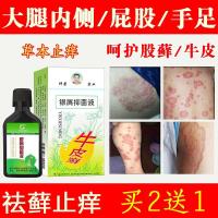 喷剂水银屑病皮肤外用水牛皮癣鹅掌风手癣病脱皮水泡脚癣一次净猫癣头皮癣膏疱疹净桃花癣真菌感染糠疹 田哥4