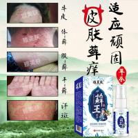 头皮藓癣喷剂水去大块头屑克星治真菌止头皮毛囊炎骚痒感染外用硫磺洗发膏脂溢性头皮煤焦油头洗发水头螨虫 大腿内侧