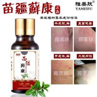 癣康抑菌液癣水成人儿童头皮癣痒灵膏大腿内侧瘙痒止痒股癣王喷剂病银屑病牛皮癣金钱癣立克真菌感染