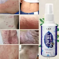 雅美肤癣王喷剂牛皮癣膏囊瘙痒疥癣痒灵皮炎狼毒肤专家湿痒王银屑病头部皮肤外用藓霸脚股癣手鹅掌风脱皮 雅美肤 苗藓王喷